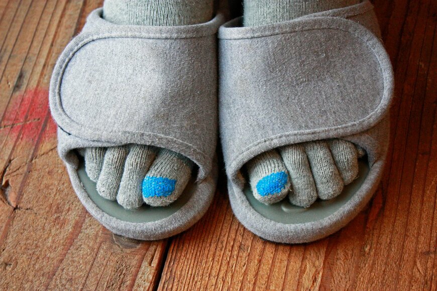 親指の穴をかわいくお直し（yy_Apartment/Shutterstock.com）