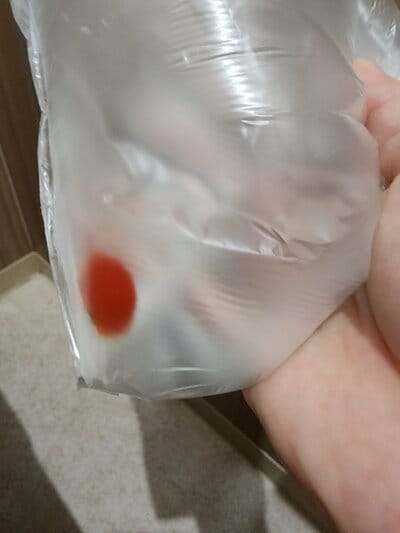 袋に入った金魚を発見