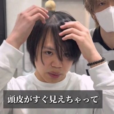 「柔らかくて密度もない、頭皮がすぐに見えちゃって…」と明かす男性