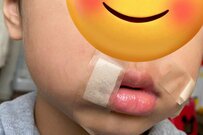 「お口が痛い」と自分で絆創膏を貼った3歳児……ほっこり癒される「あと一歩、惜しい」行動がXで話題