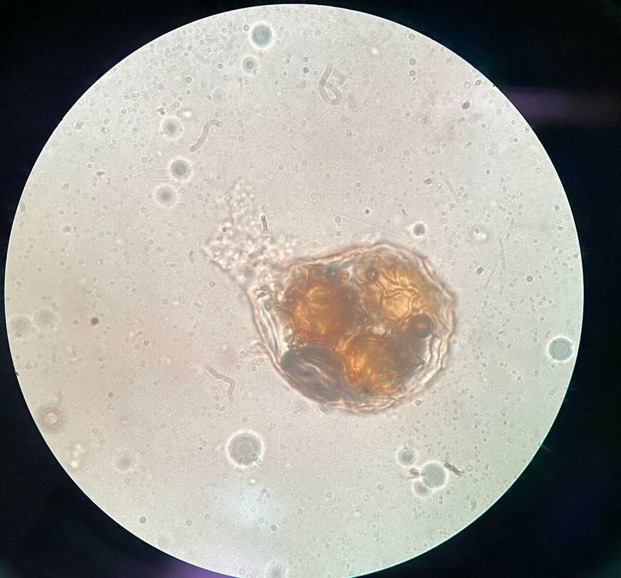 顕微鏡で確認したトリュフ塩