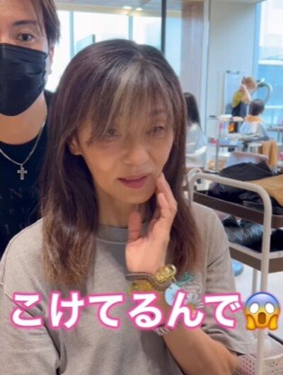 頬のこけが気になるという