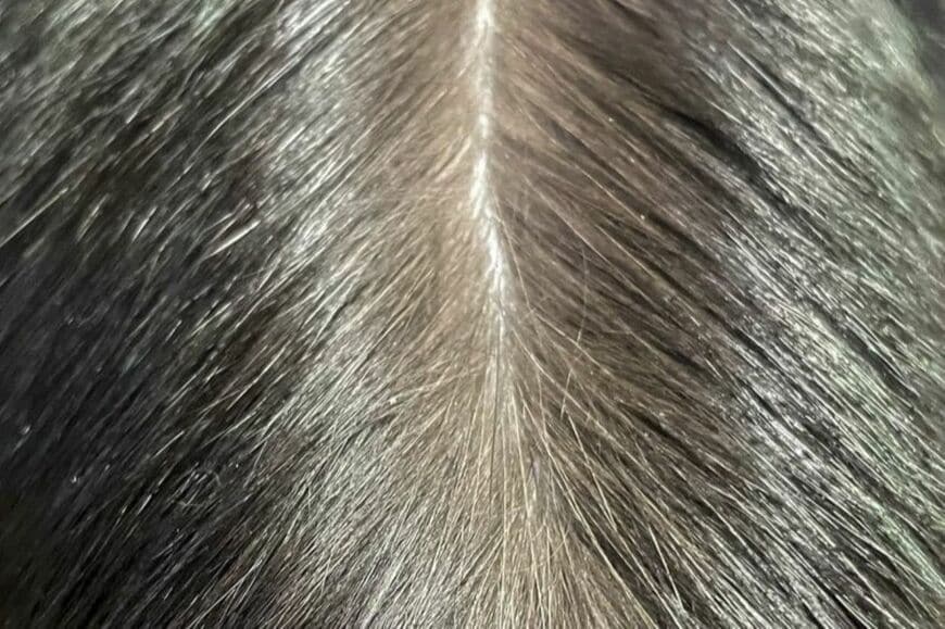 「人間の頭頂部」にしか見えない1枚に衝撃　「まさかの正体」に思わず目を疑う