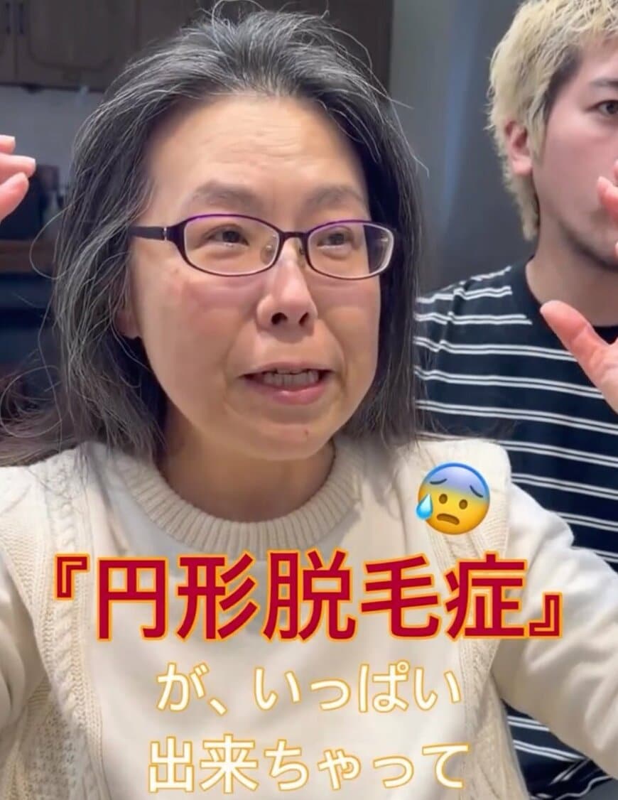 【大変身】円形脱毛症を機に…マダムがヘアドネーションで衝撃イメチェン！本人「グッドです！」