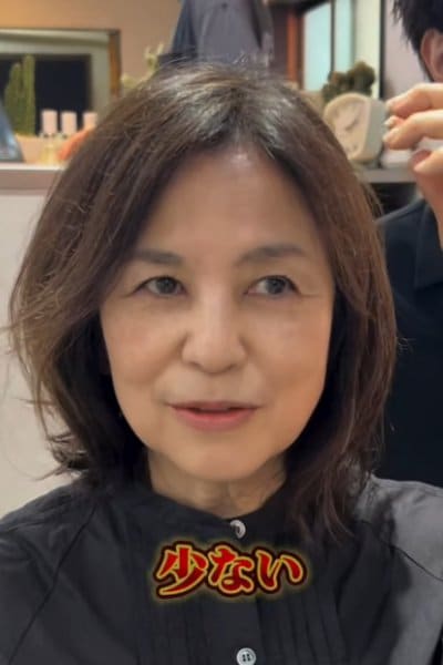 施術前の女性