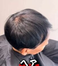 スーパーブラックで髪を染めていた男性　ブリーチ3回で「ホワイトメッシュ」に変身した姿が話題に