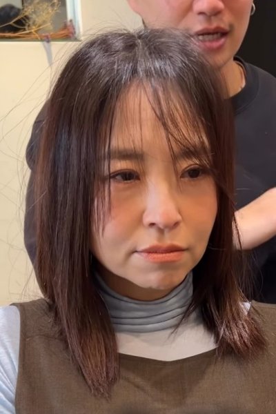 施術前の女性