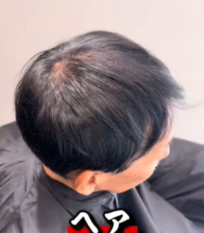 スーパーブラックで髪を染めていた男性 ブリーチ3回で「ホワイトメッシュ」に変身した姿が話題に