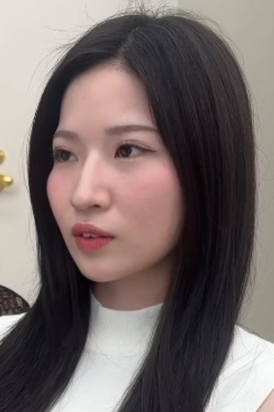施術前の女性