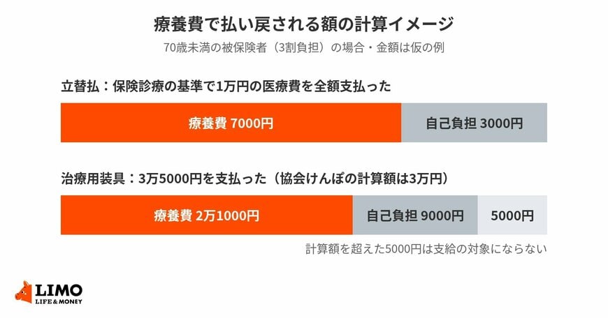 療養費は、保険診療の基準で計算した額から自己負担分を差し引いて支給される