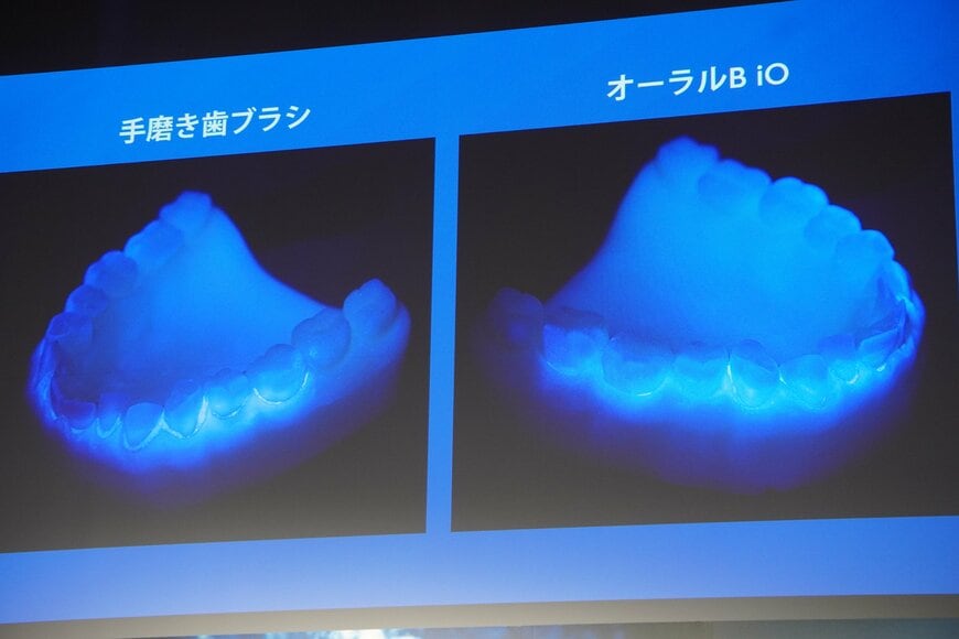 レントゲン画像