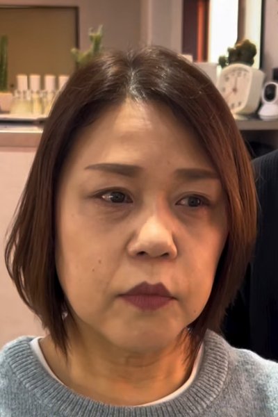 施術前の女性