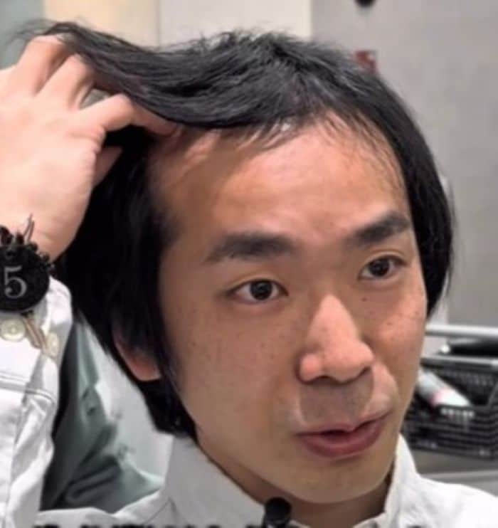 「生え際の後退をごまかしたい」結婚の前撮りを控える男性　衝撃のイメチェンに絶賛