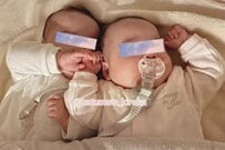 【かわいい双子】抱っこを求める妹　「1分違いで生まれた姉」の行動に思わず目を疑う