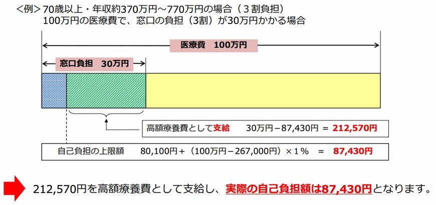 高額療養費制度とは