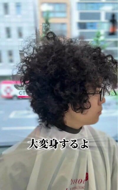 帽子なしでは外出できなかったという、ビフォーの髪型