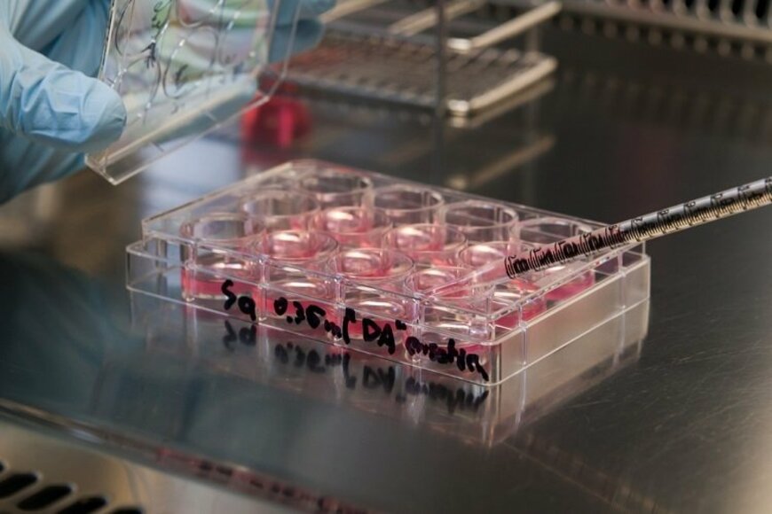 世界初、iPS細胞を使った再生医療製品の臨床試験が動き出す