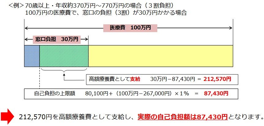 70歳以上・年収約370万円~770万円の場合(3割負担)