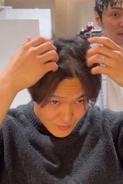 頭皮が気になる男性