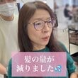 「前髪を…」薄毛に悩む女性　驚きの大変身！美しい仕上がりに「別人のよう」「すごすぎる」と反響