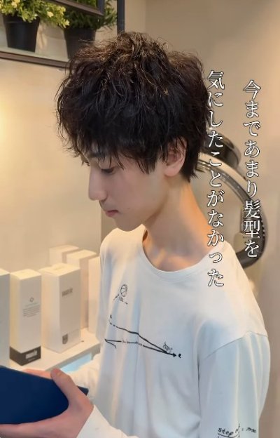 アフター写真（横顔）