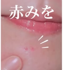 【ニキビの赤み対策】30代40代必見！長時間メイクでも白浮きしにくい徹底カバーのコツが目からウロコ！