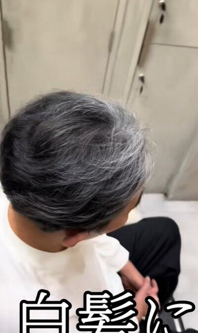 前髪に集中した白髪にお悩み