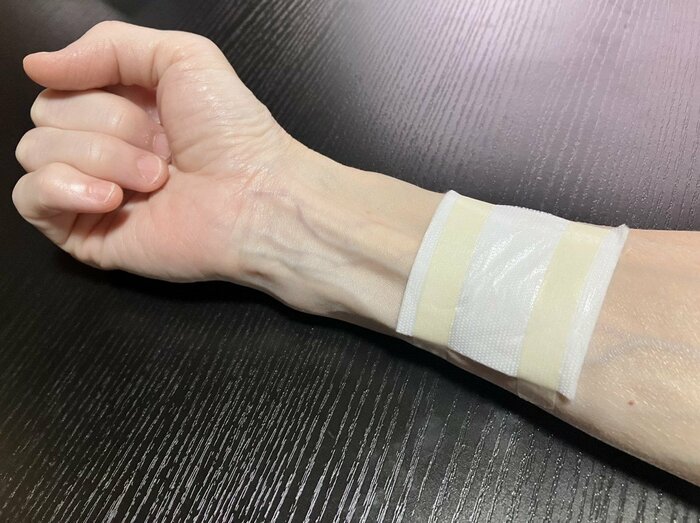 まずは滅菌パッドを患部に貼り、テープでとめました