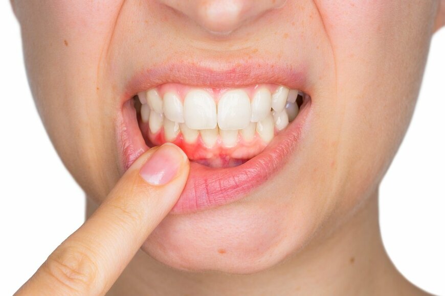 ホリエモンが「口が臭い人には仕事を発注しない」と断言する理由～歯の予防医療はなぜ必要か