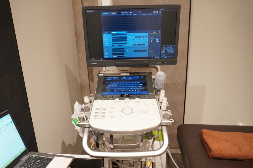 エコー検査装置の写真